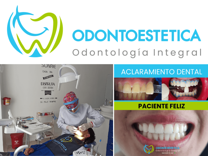 ODONTOESTETICA