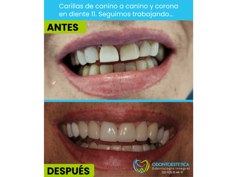 ODONTOESTETICA